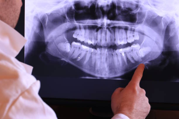 Best Emergency Broken Tooth Repair in Elizabeth City, NC