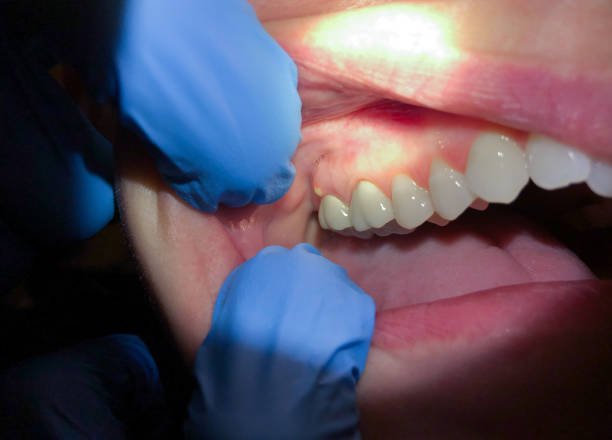 Best Emergency Dental Care for Trauma or Injury in Elizabeth City, NC